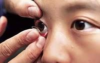 Lentes de contacto blandas duales retrasarían la miopía infantil