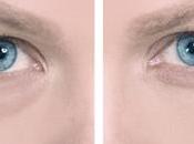 Remescar para olvidarnos bolsas ojeras