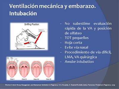 Ventilación mecánica en la embarazada