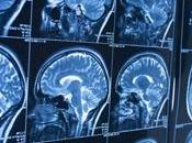 Programa informático supera radiólogos análisis cerebrales