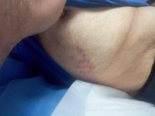 La golpiza contra el Padre Palmar