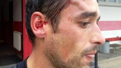 Jugador español recibe una brutal paliza en el fútbol alemán