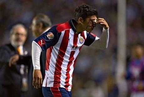 Zaldivar estará 3 semanas de baja por fractura de nariz