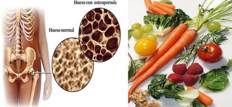 Dieta y Osteoporosis