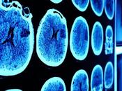 estrés postraumático afecta niños niñas manera diferente