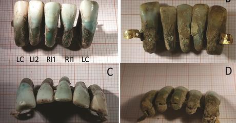 Dentadura postiza de 400 años de antigüedad es hallada por arqueólogos en Italia