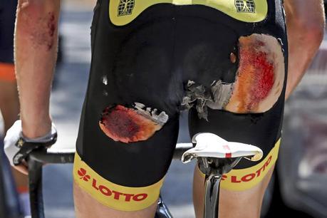 Las 5 lesiones más habituales del ciclismo