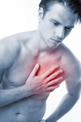 Síntomas de infarto