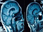 Descubren origen depresión cerebro
