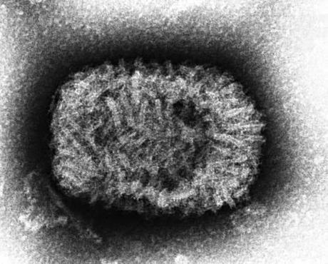 Los 9 virus más mortales de la Tierra