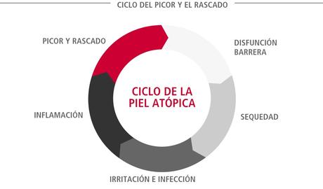 El ciclo de la piel atópica (también conocido como ciclo del picor y el rascado) 