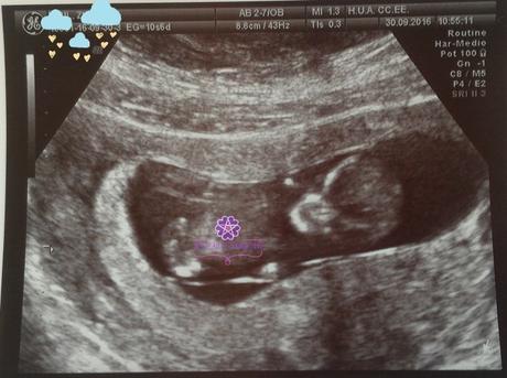 Embarazo: Actualización Septiembre y Octubre