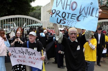 Ébano y marfil: la persecución del albinismo en África Ébano y marfil: la persecución del albinismo en África