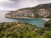 Pacientes experimentan nuevos síntomas visuales después cirugía refractiva