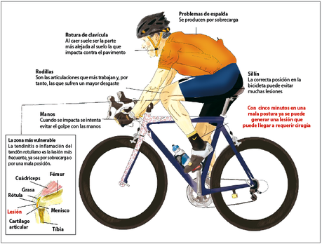 Lo que todo ciclista debe saber acerca de problemas en los huesos.
