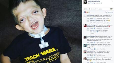 La madre que lucha contra los memes que se burlan de su hijo de 3 años gravemente enfermo