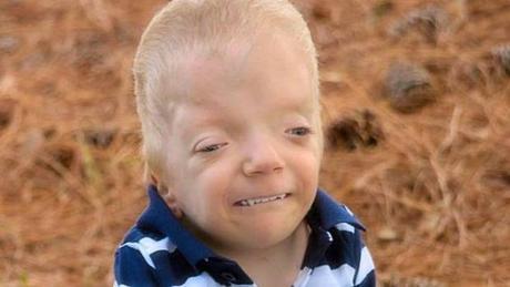 La madre que lucha contra los memes que se burlan de su hijo de 3 años gravemente enfermo