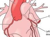 Aterosclerosis, Angina Pecho Infarto Cardiaco