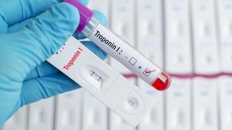 La sencilla prueba que te dice si tienes un corazón sano