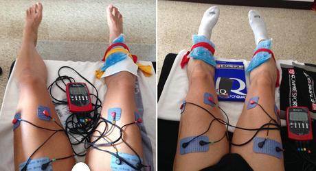 electroestimulación