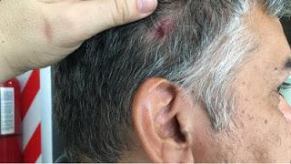 Denuncian que el ataque a la camioneta de Macri en Neuquén fue 