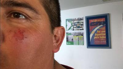 Denuncian que el ataque a la camioneta de Macri en Neuquén fue 