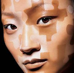 El vitiligo: ¿manchas emocionales?