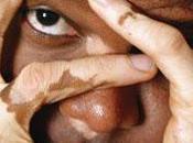 Difícil tratamiento