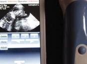 Ecografías teléfono móvil