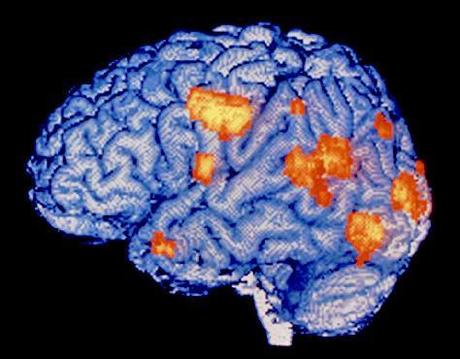 Algunas ideas acerca de nuestro maravilloso cerebro. Algunas ideas acerca de nuestro maravilloso cerebro.