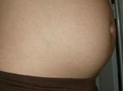 niveles bajos cobre cinc están asociados aborto espontáneo