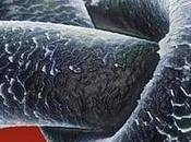 Alopecia indicio cáncer próstata