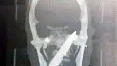 QUEMA MUCHO EL SOL XXIV.