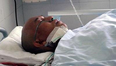 QUEMA MUCHO EL SOL XXIV.