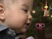 Reparan cráneo bebé gracias tecnología