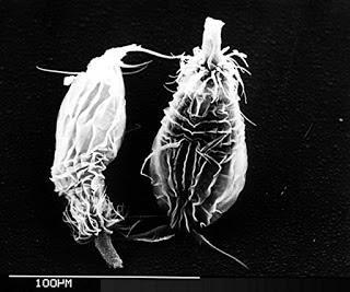 Loricifera, un nuevo phylum de invertebrados