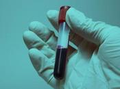 Estamos cerca diagnosticar Alzheimer través muestra sangre