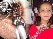 Muchacha india tiene hormigas salen oídos cada