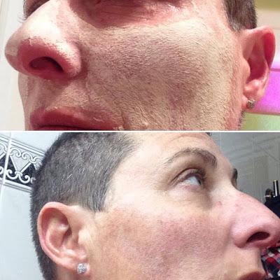 Mascarilla facial, mascarilla, mascarilla natural, mascarilla dérmica, mascarilla flor de tilo, fontdeblanc, cosmética natural, viernes de spa, blogger alicante, solo yo, blog solo yo, beauty blogger, youtuber, 