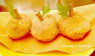 CROQUETAS RECOPILATORIO Y OTROS