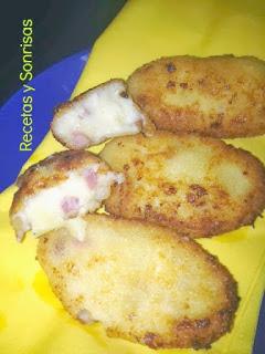 CROQUETAS RECOPILATORIO Y OTROS