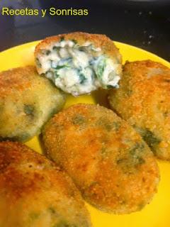 CROQUETAS RECOPILATORIO Y OTROS