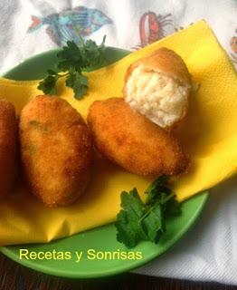 CROQUETAS RECOPILATORIO Y OTROS