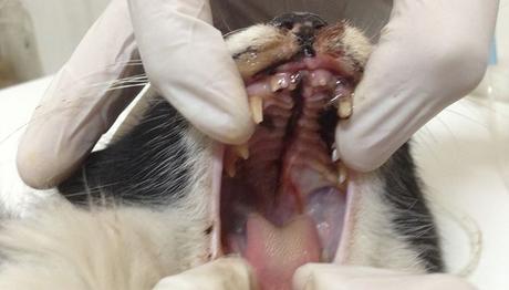 las fracturas son muy comunes