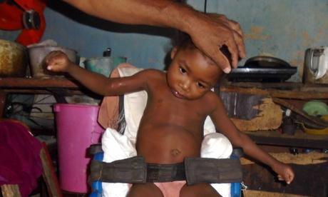 En Santiago de Cuba un niño con parálisis cerebral sobrevive abandonado a su suerte