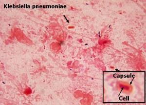 klebsiella_pneumoniae bacterias