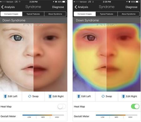 La inteligencia artificial puede ayudar a diagnosticar enfermedades