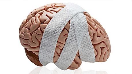 Lesiones Cerebrales: ¿Cuál es el riesgo cuando vamos en bici?