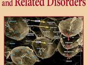 Porque estan Incrementando Enfermedades Cardiometabolicas