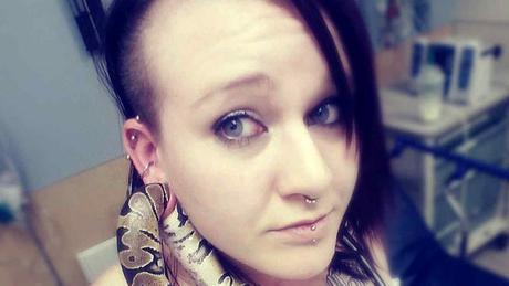 El “arete” de esta joven no fue intencional y la llevó directo al hospital (FOTOS) El “arete” de esta joven no fue intencional y la llevó directo al hospital (FOTOS)